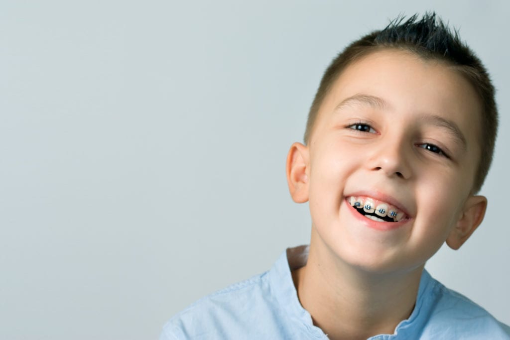 Braces in San Ramon, CA 